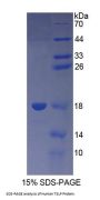 Human Thymic Stromal Lymphopoietin (TSLP) Protein
