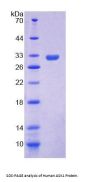 Human Apoptosis Signal Regulating Kinase 1 (ASK1) Protein