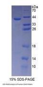 Human Cadherin 5 (CDH5) Protein