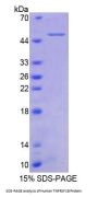Human Tumor Necrosis Factor Receptor Superfamily Member 1B / CD120b (TNFRSF1B) Protein