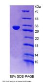 Human Neuronal Apoptosis Inhibitory Protein (NAIP) Protein