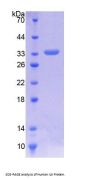 Human Integrin-Linked Protein Kinase (ILK) Protein