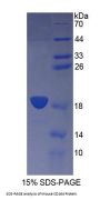 Mouse Sialomucin Core Protein 24 (CD164) Protein