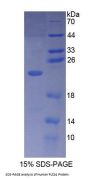 Human Phospholipase C Beta 1, Phosphoinositide Specific (PLCb1) Protein