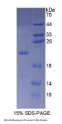 Human Phospholipase C Beta 3, Phosphoinositide Specific (PLCb3) Protein