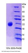 Mouse Phospholipase C Beta 3, Phosphoinositide Specific (PLCb3) Protein