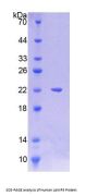 Human Lysosomal Associated Membrane Protein 3 (LAMP3) Protein