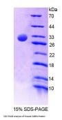 Mouse C4b-Binding Protein Alpha Chain (C4BPA) Protein