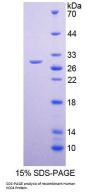 Human Potassium Chloride Cotransporters 4 (KCC4) Protein