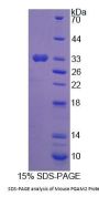 Mouse Phosphoglycerate Mutase 2, Muscle (PGAM2) Protein