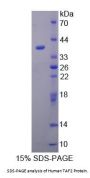 Human TATA Box Binding Protein Associated Factor 2 (TAF2) Protein