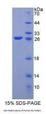 Human Kell Protein (KEL) Protein