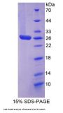 Signal Transducer And Activator Of Transcription 3 (STAT3) Protein