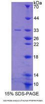 Human Prostaglandin F2 Receptor Negative Regulator (PTGFRN) Protein