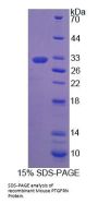 Mouse Prostaglandin F2 Receptor Negative Regulator (PTGFRN) Protein