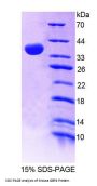 Mouse Guanylate Binding Protein 4 (GBP4) Protein