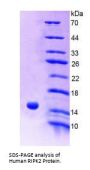 Human Receptor Interacting Serine Threonine Kinase 2 (RIPK2) Protein