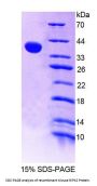 Mouse Receptor Interacting Serine Threonine Kinase 2 (RIPK2) Protein