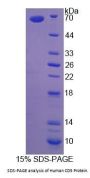 Human T-Cell Surface Glycoprotein CD5 (CD5) Protein