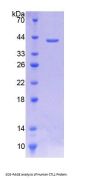 Human Choline Transporter Like Protein 1 (CTL1) Protein