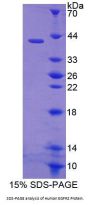 Human Receptor Tyrosine-Protein Kinase ErbB-2 (ERBB2) Protein