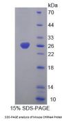 Mouse Cholinergic Receptor, Nicotinic, Alpha 4 (CHRNa4) Protein
