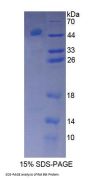 Rat Bruton'S Tyrosine Kinase (Btk) Protein