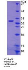 Human Wiskott Aldrich Syndrome Protein (WASP) Protein