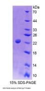 Rat Sperm Protein 17 (Sp17) Protein