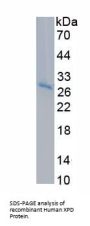 Human Xeroderma Pigmentosum, Complementation Group D (XPD) Protein