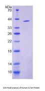Human 17-Alpha-Hydroxylase (S17aH) Protein
