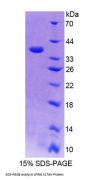 Rat 17-Alpha-Hydroxylase (S17aH) Protein