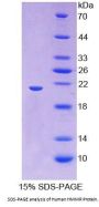 Human Hyaluronan Mediated Motility Receptor (HMMR) Protein
