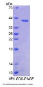Human Bone Morphogenetic Protein 3 (BMP3) Protein
