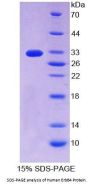 Human V-Erb A Erythroblastic Leukemia Viral Oncogene Homolog 4 (ErbB4) Protein