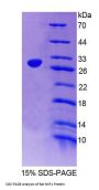 Rat Nuclear RNA Export Factor 1 (NXF1) Protein