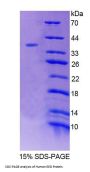 Human Embryonic Ectoderm Development (EED) Protein