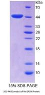 Rat E1A Binding Protein P300 (EP300) Protein