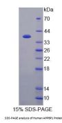 Human Amyloid Beta Precursor Protein Binding Protein 1 (APPBP1) Protein