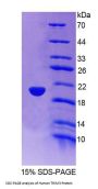 Human Tripartite Motif-Containing Protein 3 (TRIM3) Protein