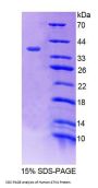 Human Atrophin 1 (ATN1) Protein