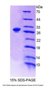 Human Actinin Alpha 1 (ACTN1) Protein