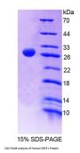Human Serine/Arginine Rich Splicing Factor 1 (SRSF1) Protein