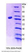 Human Centromere Protein J (CENPJ) Protein