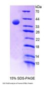 Human Erythrocyte Membrane Protein Band 4.1 (EPB41) Protein