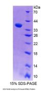 Mouse Erythrocyte Membrane Protein Band 4.1 (EPB41) Protein