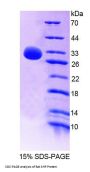 Rat Small Heterodimer Partner (SHP) Protein