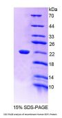 Human Endothelial Differentiation-Related Factor 1 (EDF1) Protein