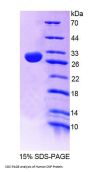 Human 2, 3 Cyclic Nucleotide 3 Phosphohydrolase (CNP) Protein