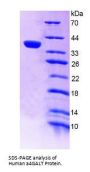Human Lactosylceramide 4-Alpha-Galactosyltransferase (A4GALT) Protein